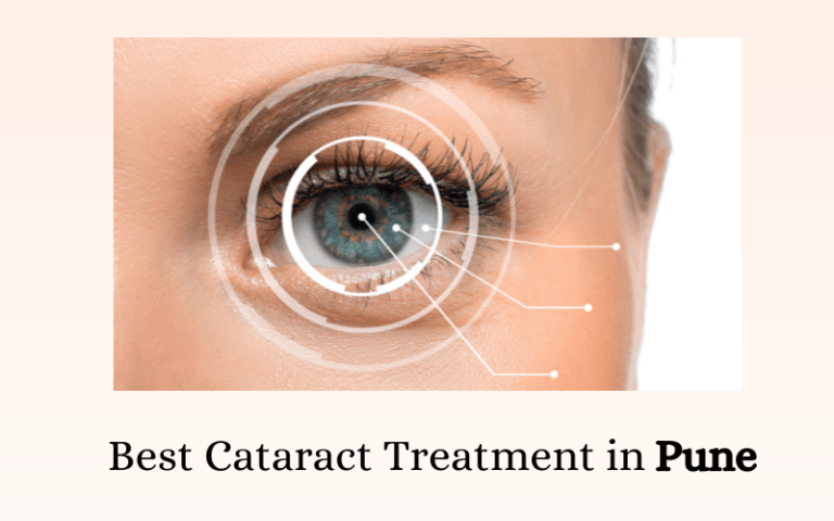 Best Cataract Treatment in Pune